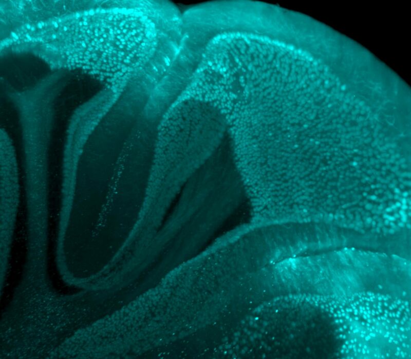 Close-up Of 3D Light Sheet Imaged Mouse Brain Following Anti-obesity Drug Treatment