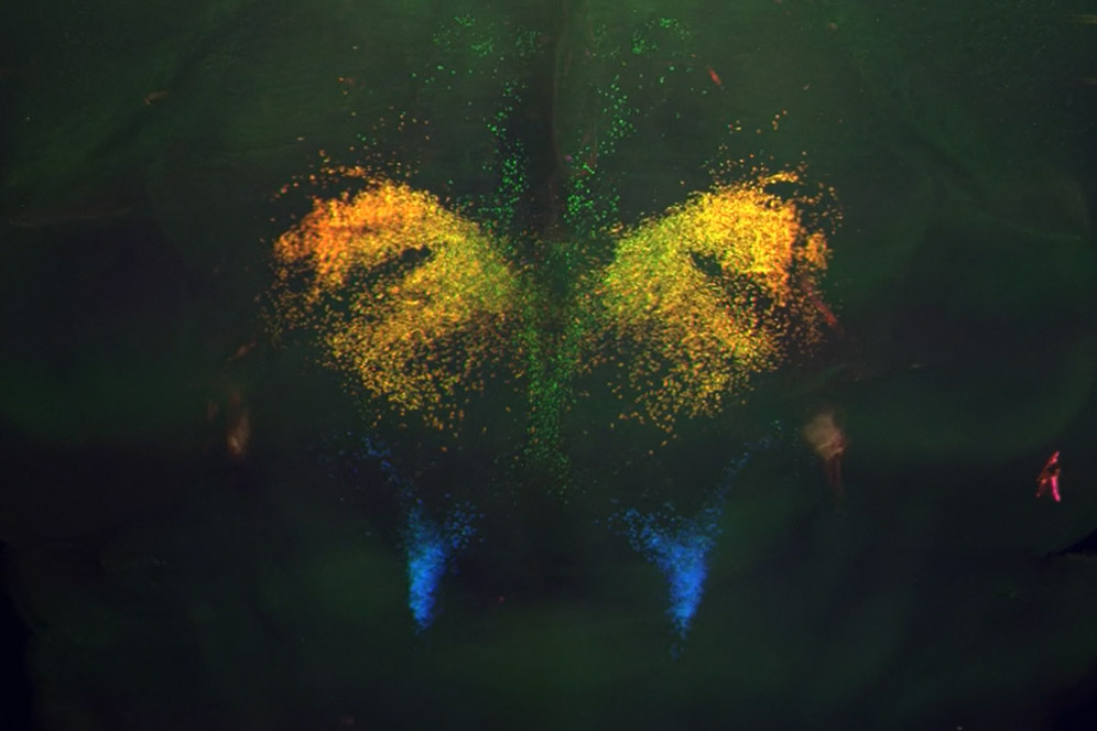 3d_stained_mouse_brain