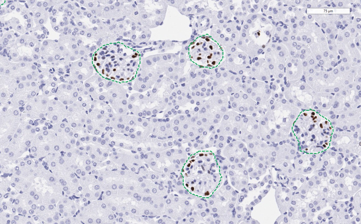 Detection of glomeruli in a murine kidney done by AI-based image analysis
