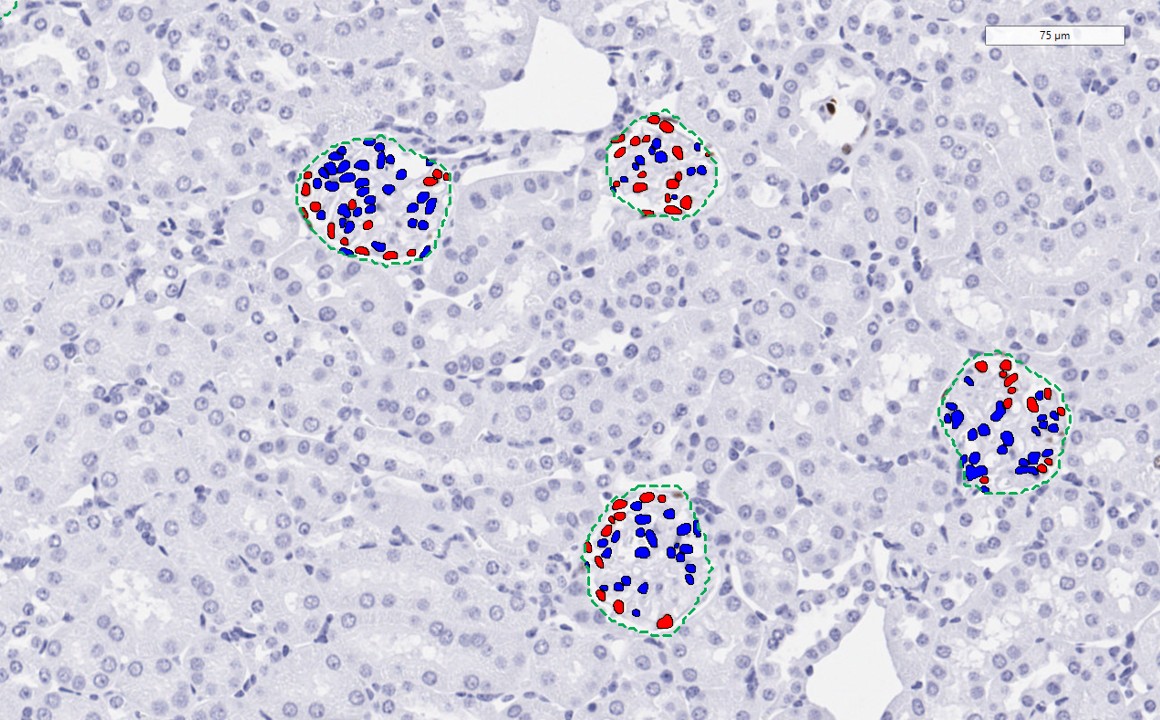 Identification of podocytes and non-podocytes in the glomeruli